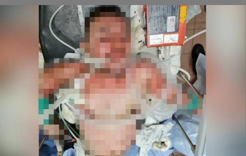 BAKAR BENGKEL KERETA TAK PUAS HATI KERETA MASIH ROSAK